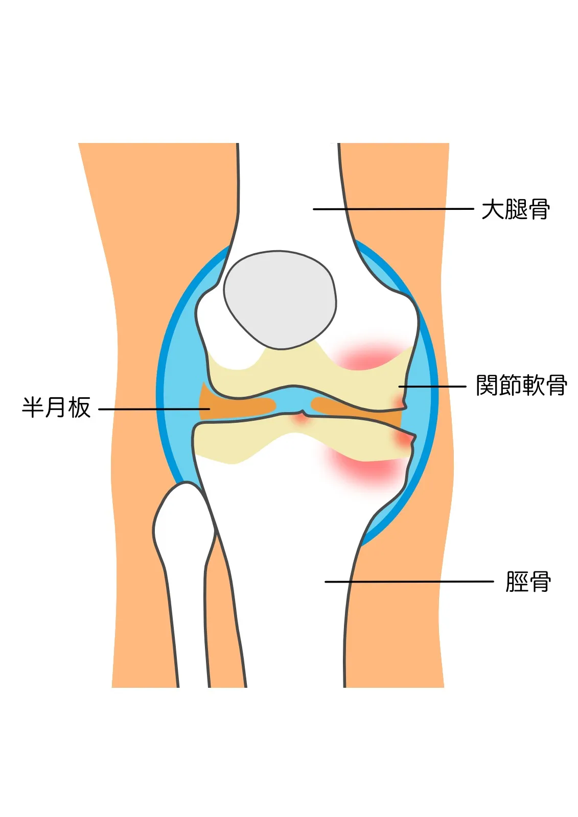 変形性膝関節症・膝痛は歩き方で改善(*^▽^*)股関節の向きが大事！　｜練馬区土支田さくら整体