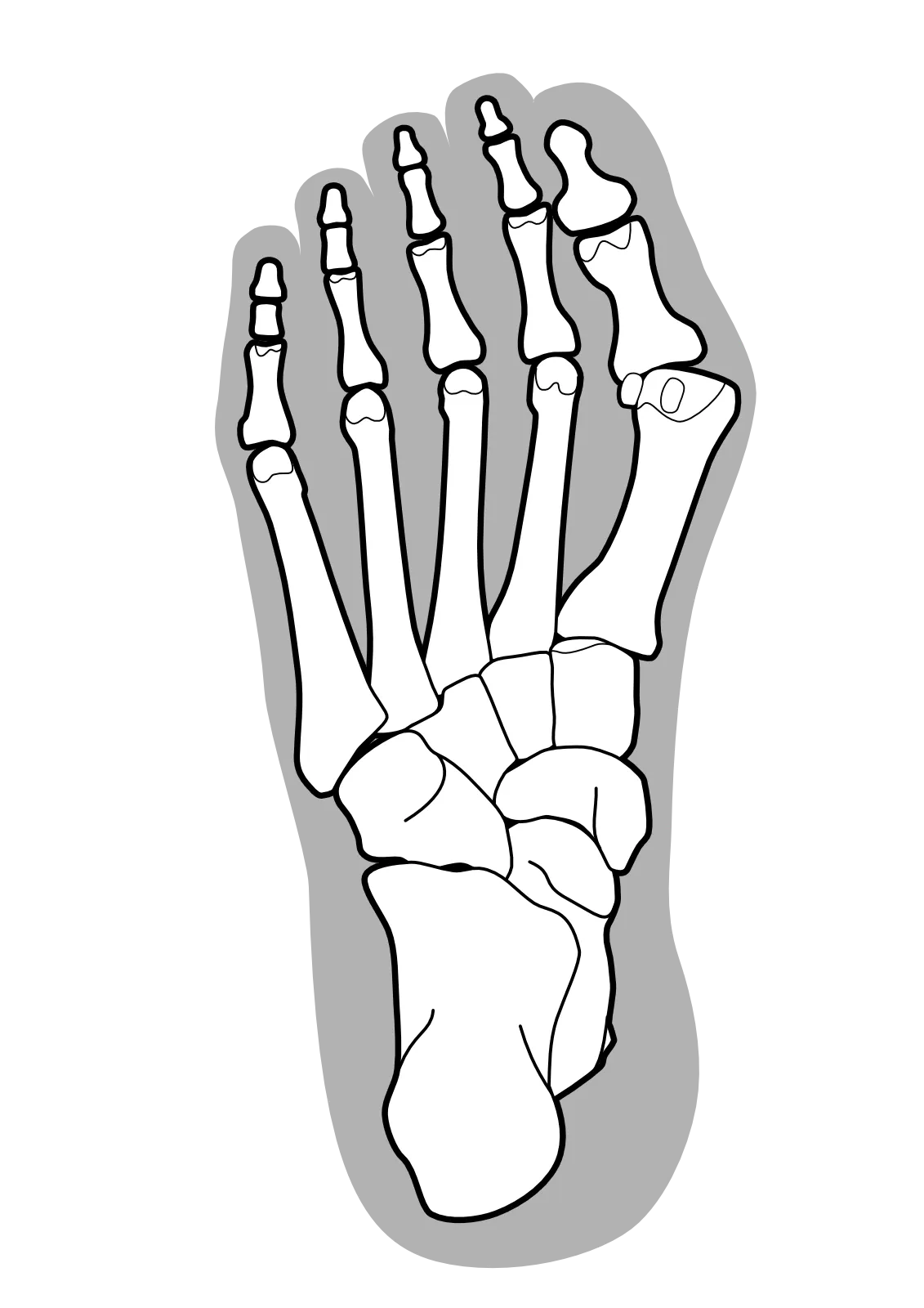 外反母趾の親指、足の甲をマッサージして柔らかくしたら、ますます足幅が広がってしまった(>_<)